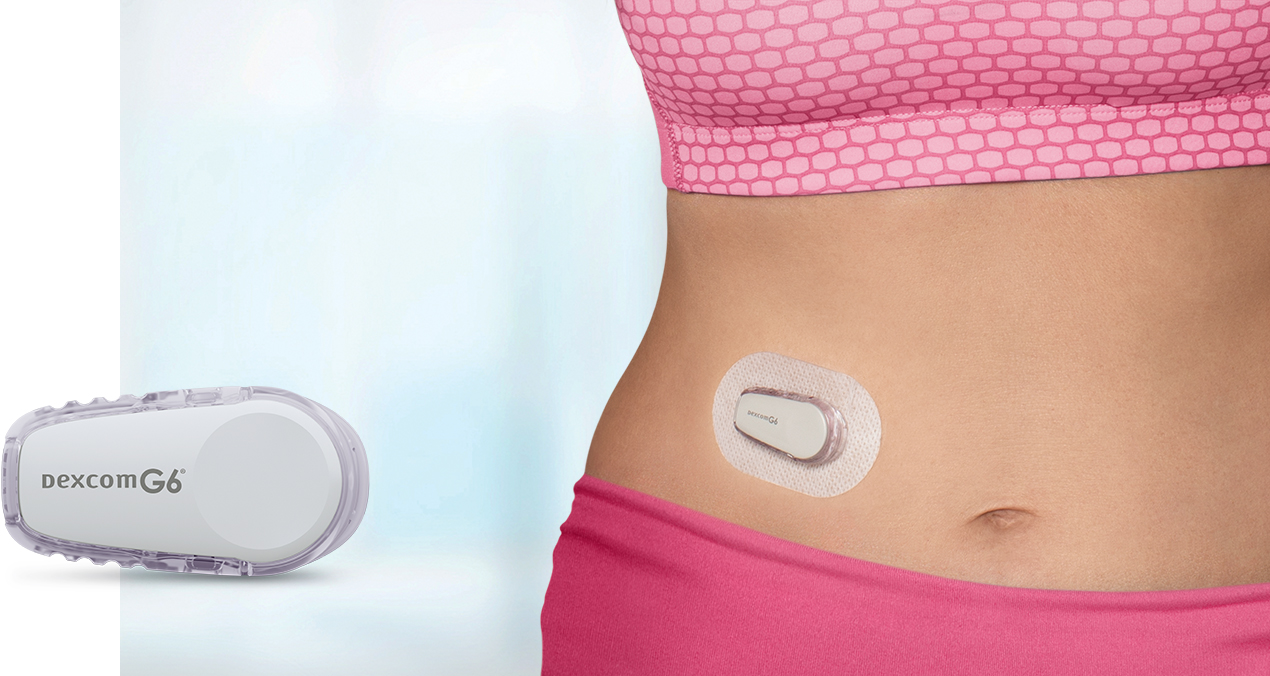 Dexcom CGM on Customer